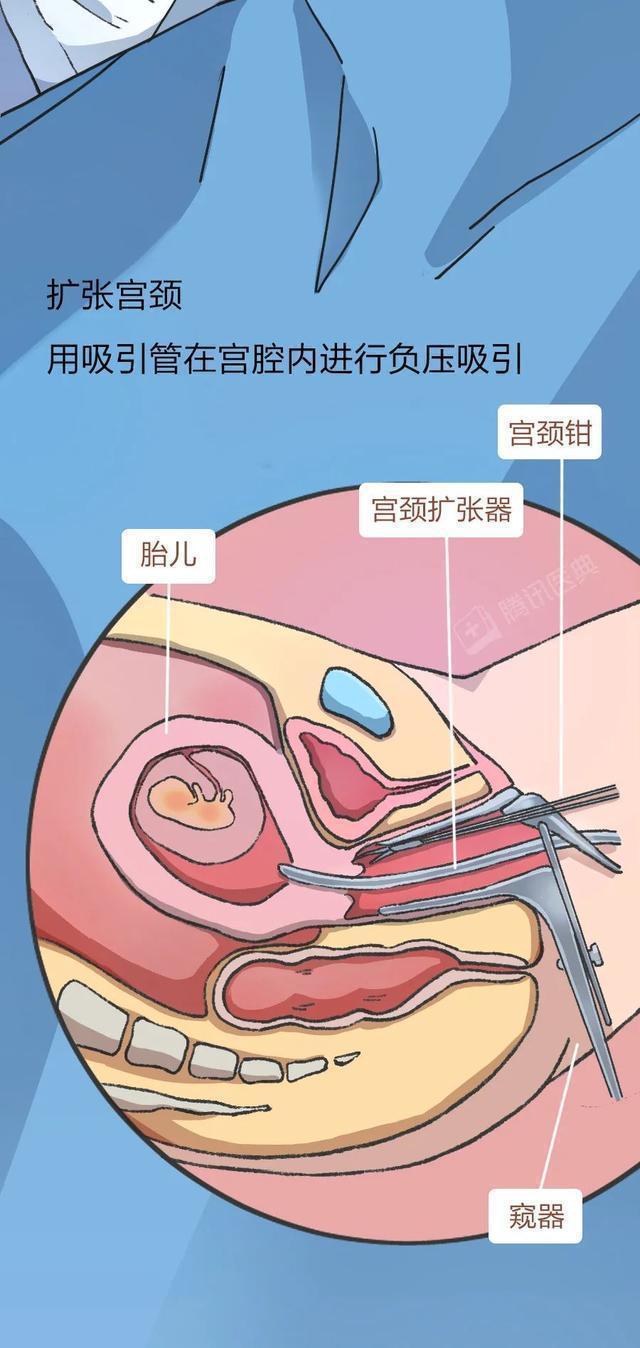 砸汽车小游戏_手机砸车游戏视频_砸车游戏动图